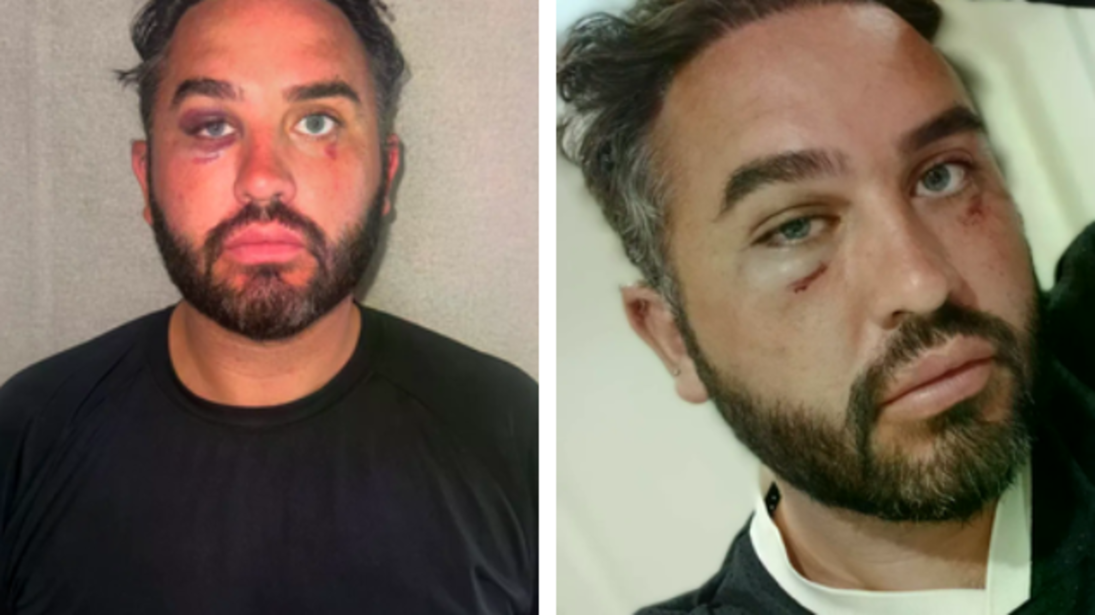 Hughie Maughan says he was attacked by two Kerry fans after toasting Mayo’s All-Ireland win