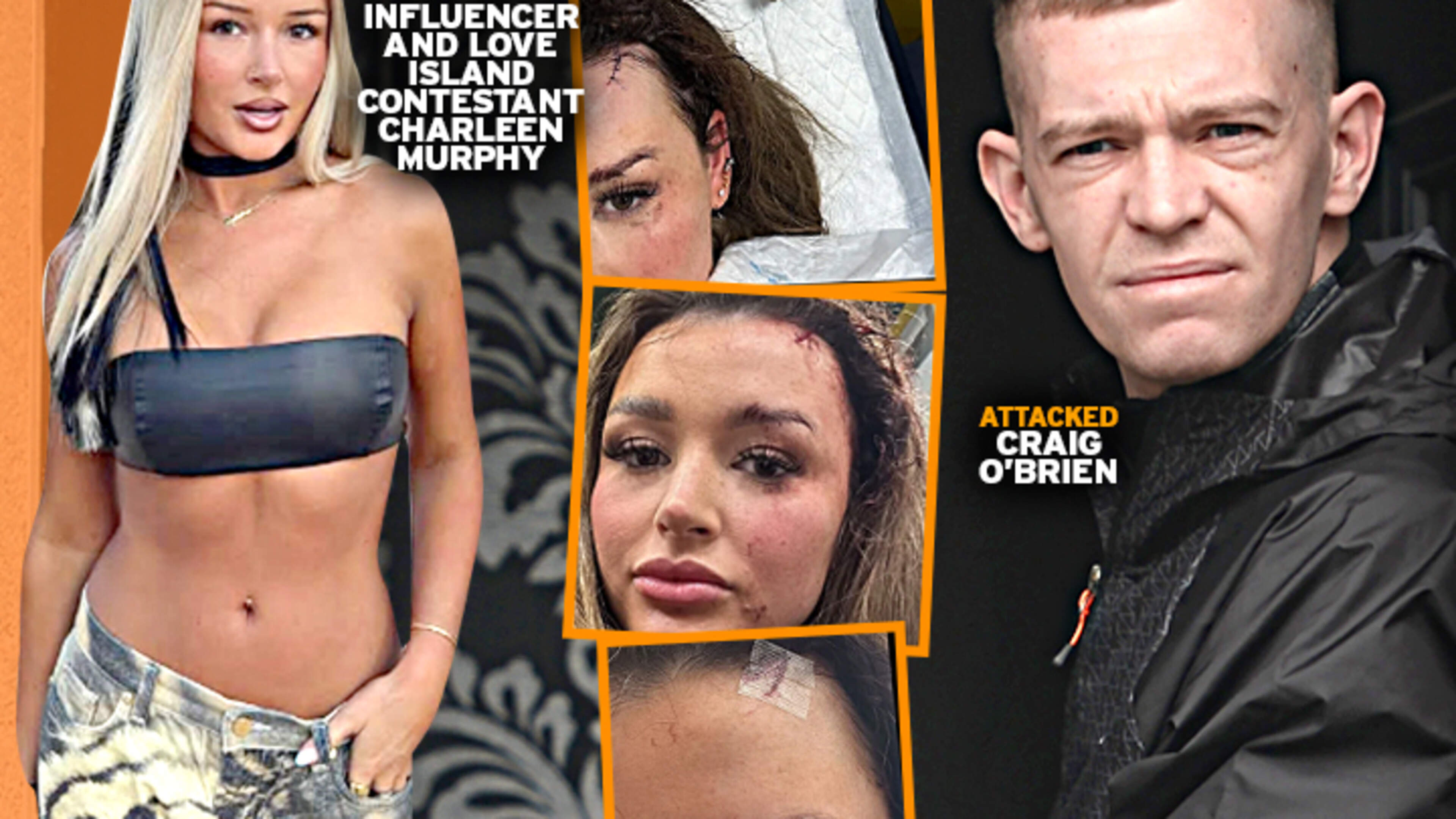 Stalk of Fame: Love Island’s Charleen Murphy not only Irish star to fall victim to violence 