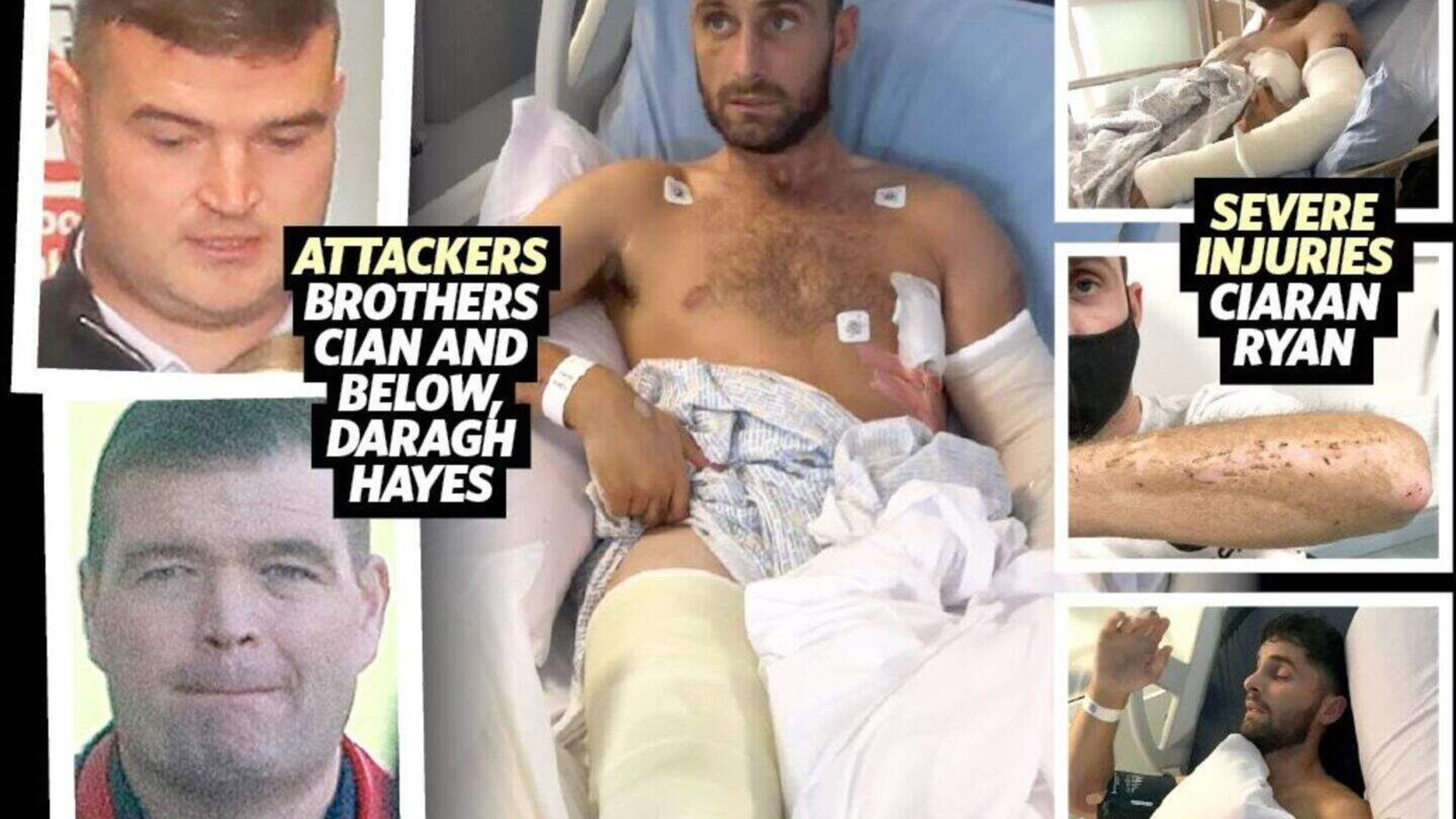 Kyle Hayes’ brothers freed from prison after serving just one year for horrific hurl attack