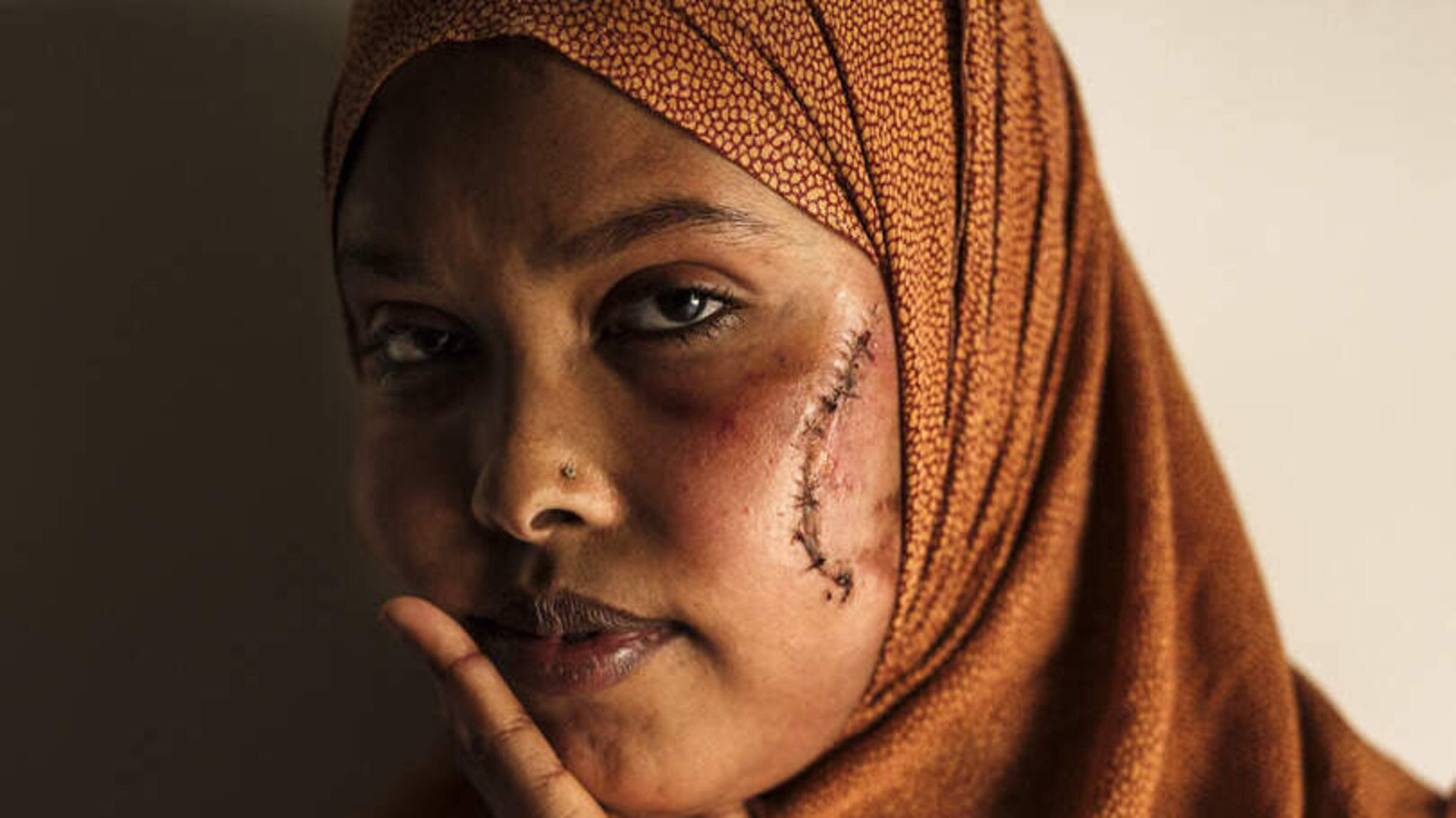 Woman (22) left with facial scars after being slashed during alleged attack on O’Connell Street