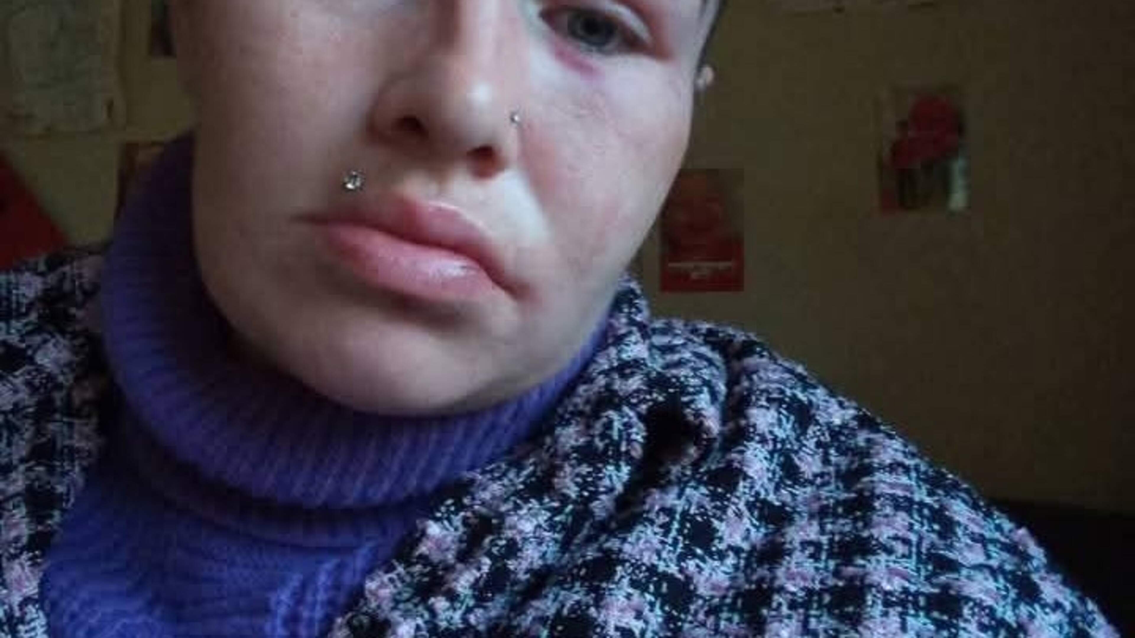 ‘You’re not a rat if you go to gardai’- Woman thought she would die during 70-minute attack by ex