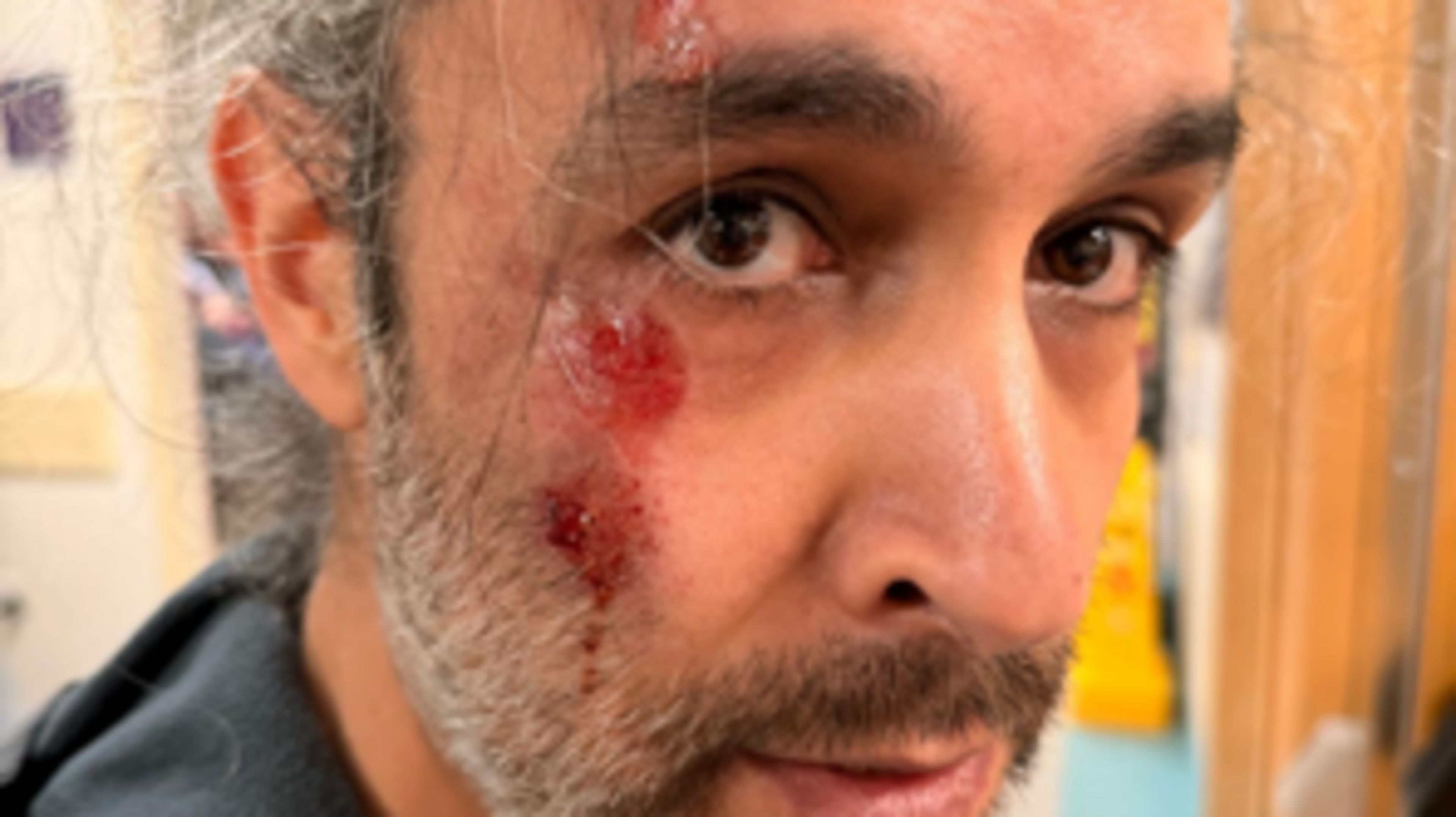 Musician robbed and thrown from moving car after being set up on DoneDeal reveals ordeal