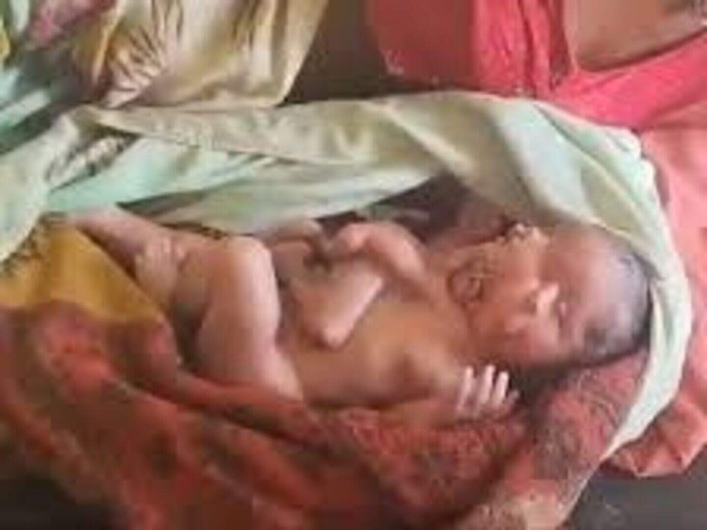 Doctors in India reveal details of tragic baby born with four legs, four  arms and two faces | Crime World