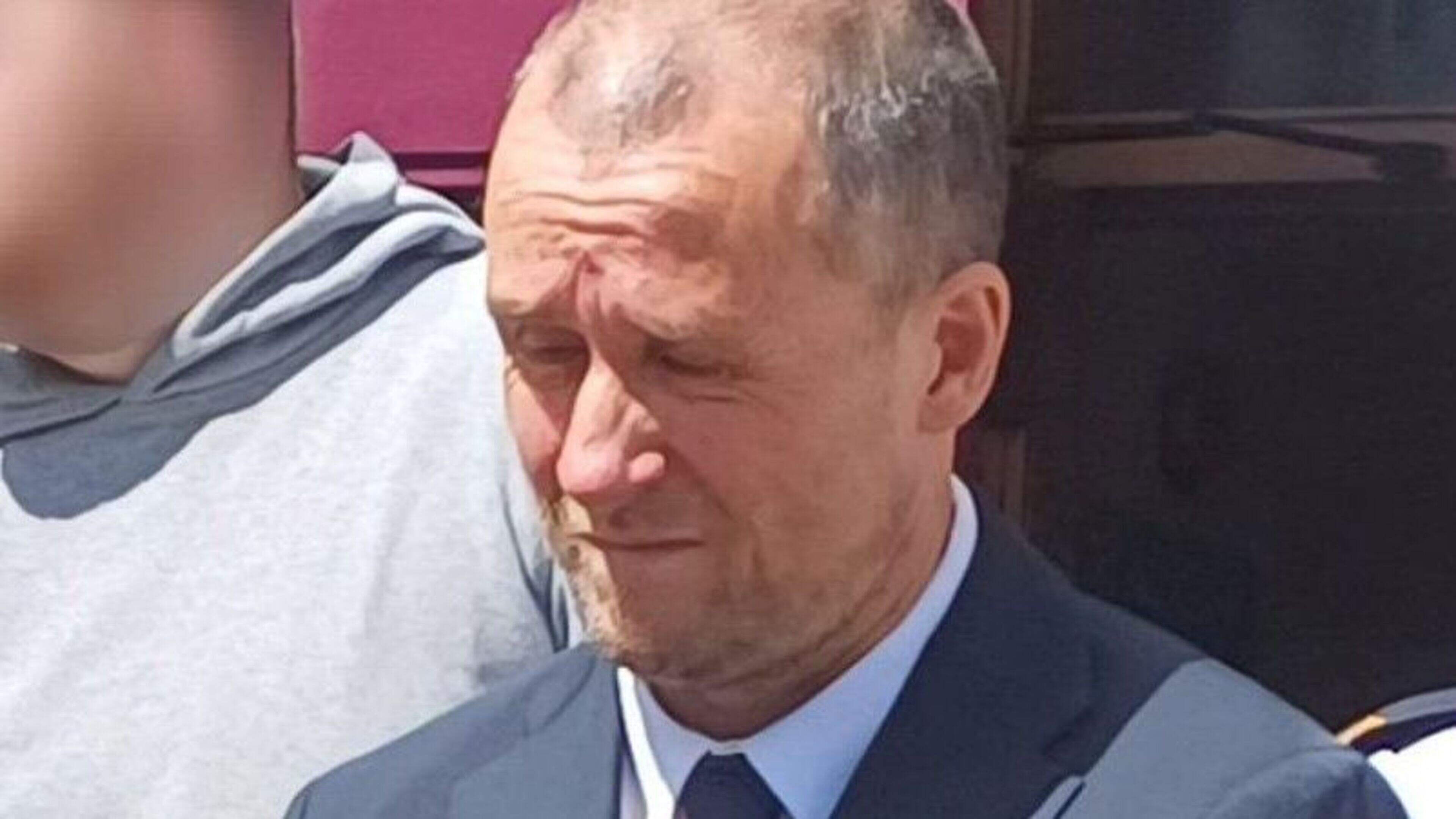 Man left granny disfigured while she collected grandchild during random attack spree