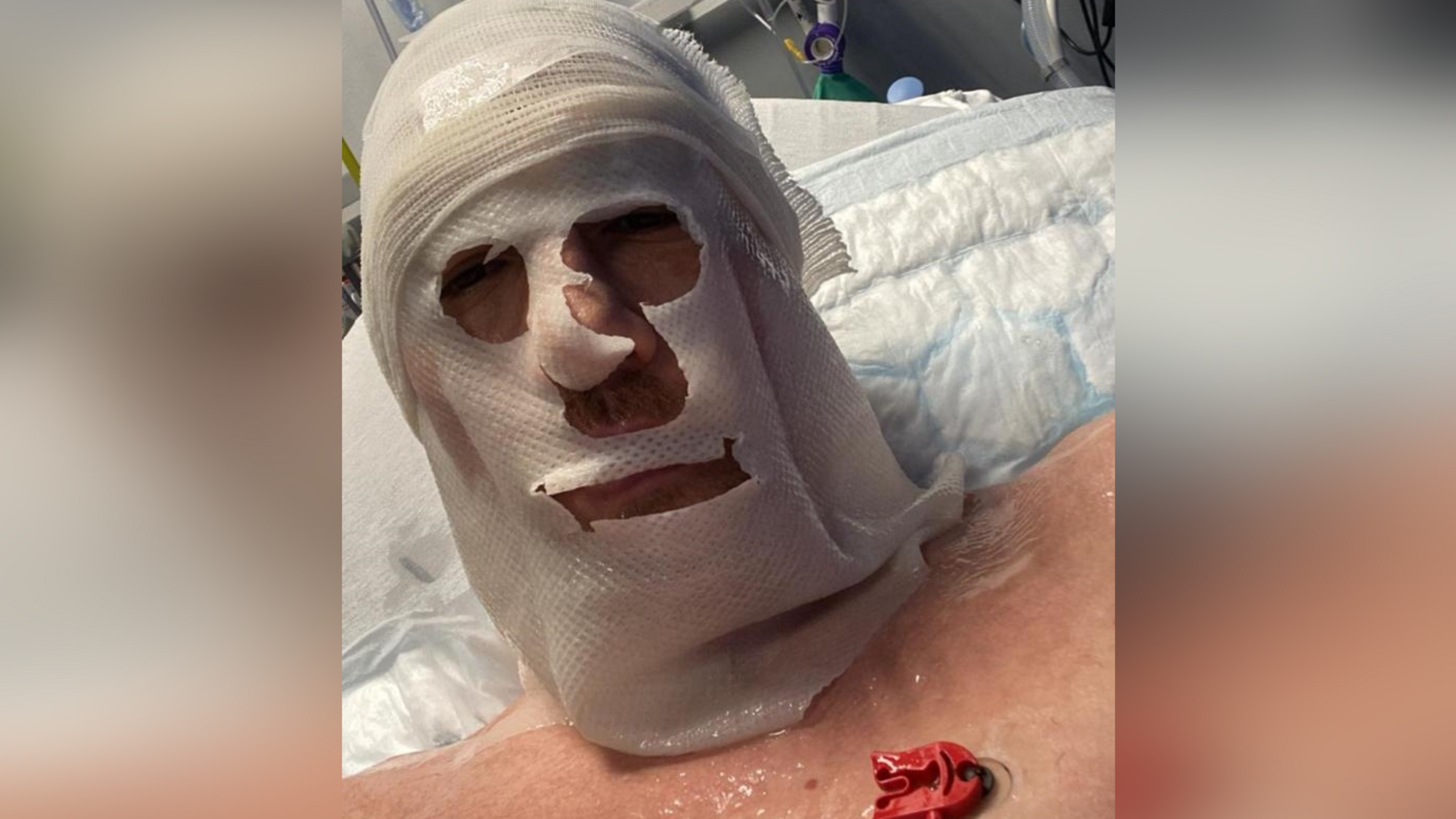 ‘The pain is unbearable’: Victim of courthouse boiling water attack speaks from hospital bed 