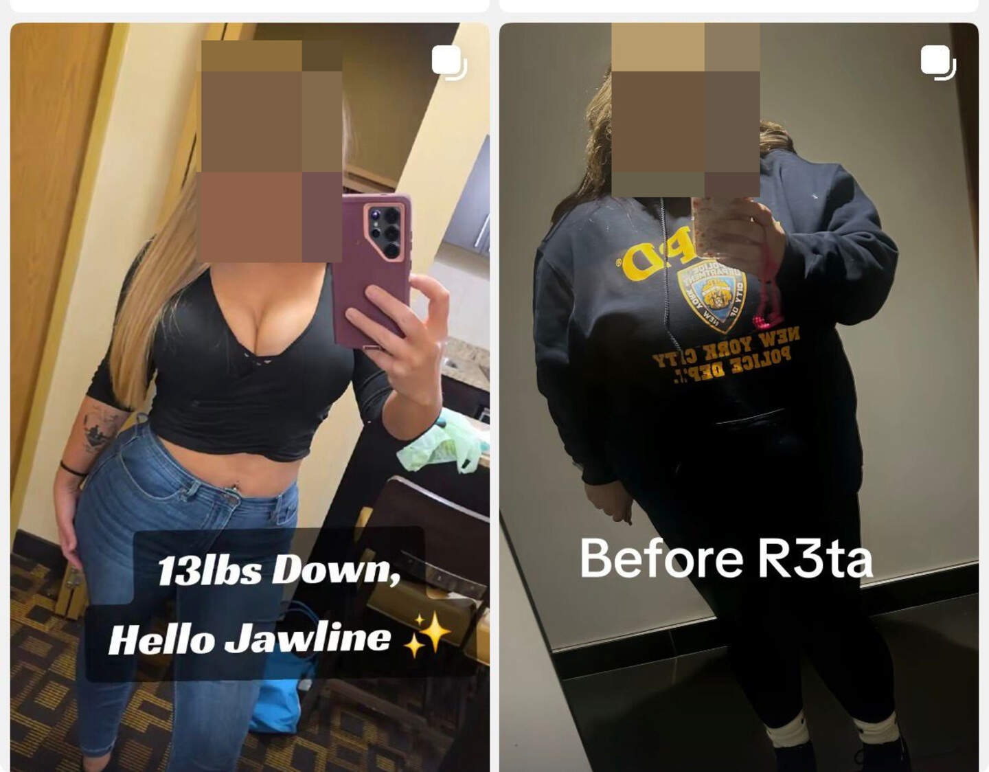 retatrutide meaning How Does Retatrutide Make You Lose Weight? The Science of the 