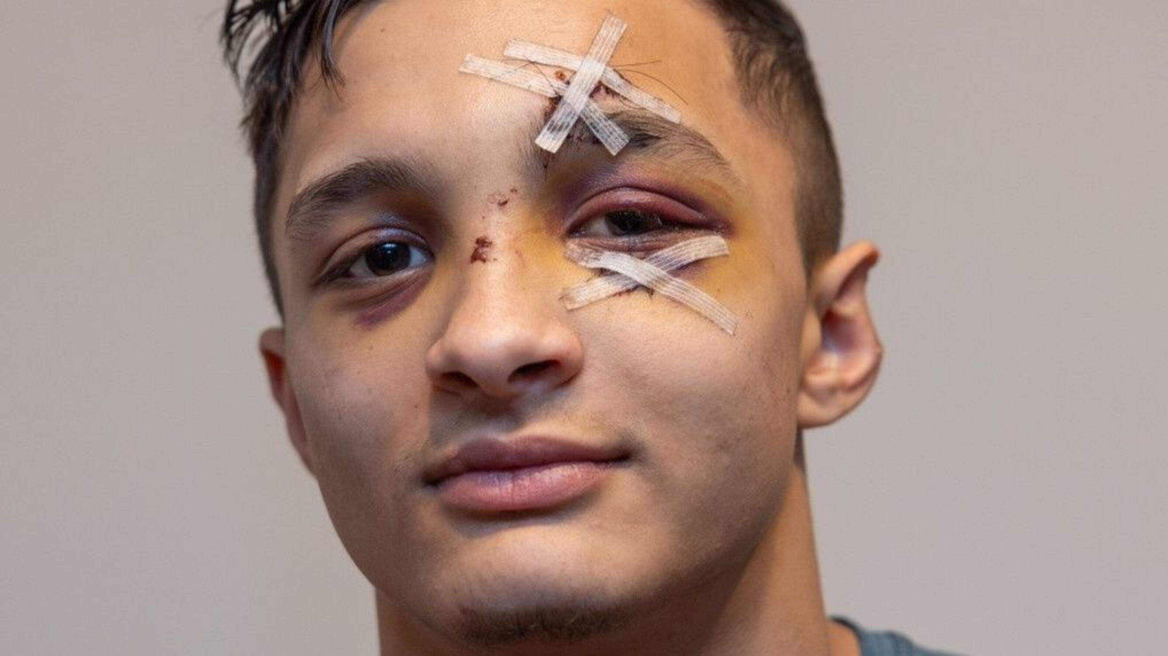 Garda facing charge over alleged assault on teenager Justin Covaci during arrest 