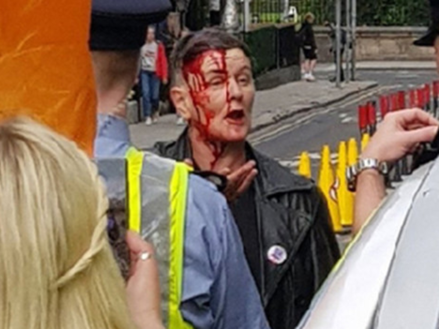 Louth man who struck woman with wooden post during anti-lockdown rally ...