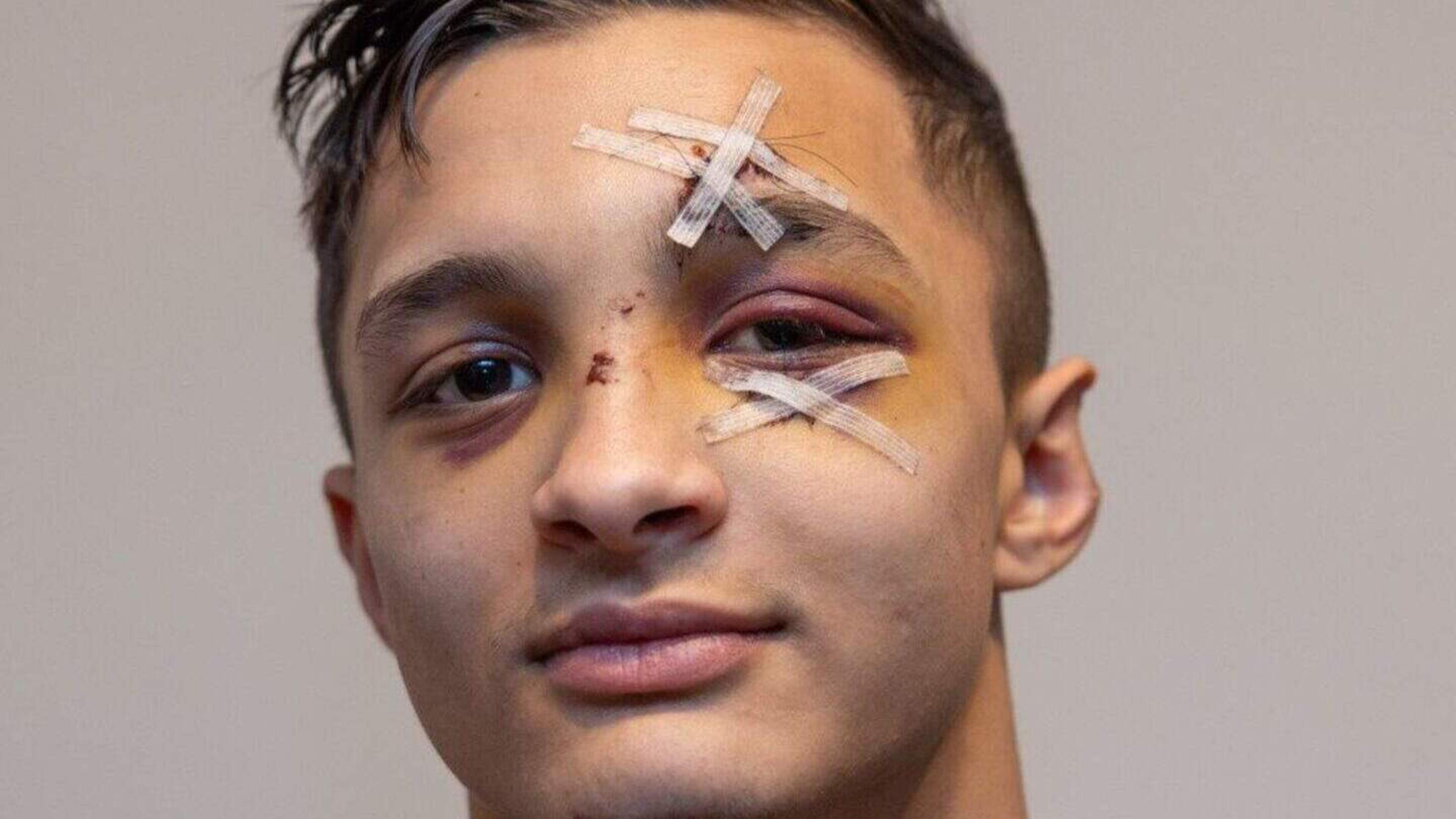 Garda faces charge over alleged assault on teen Justin Covaci during Dublin arrest 