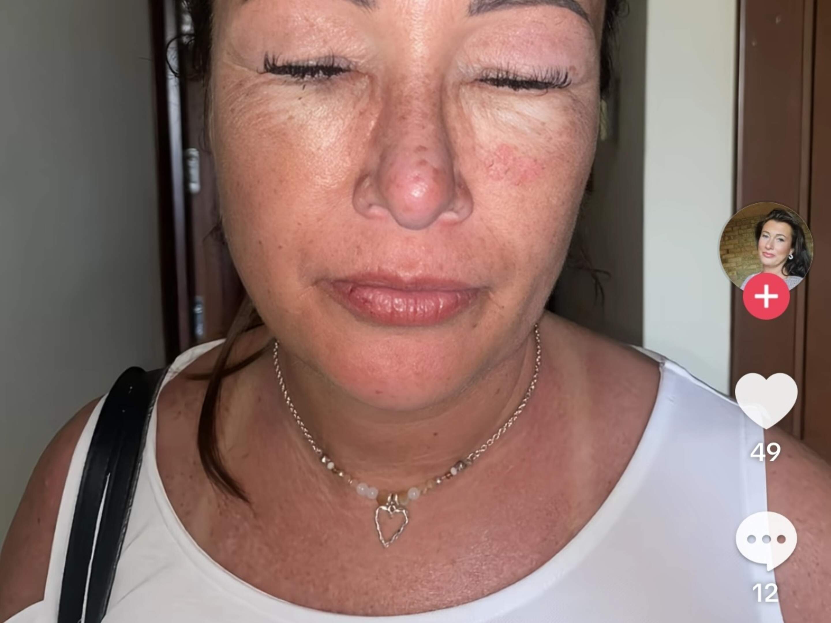 ginger melanotan before and after Is this injectable tanning drug safe to use?