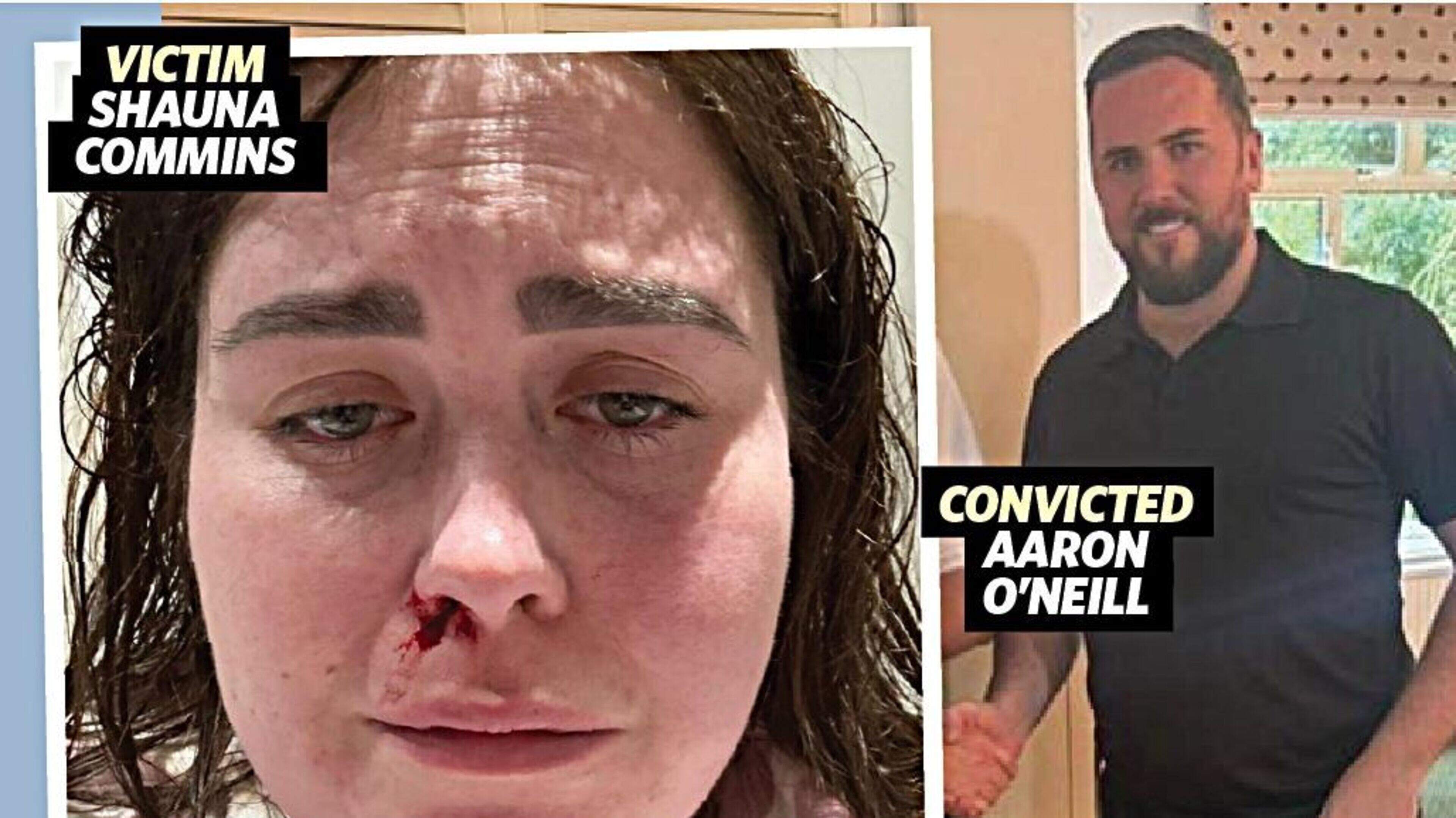 Woman who suffered years of violence from husband blasts use of counselling notes at trials